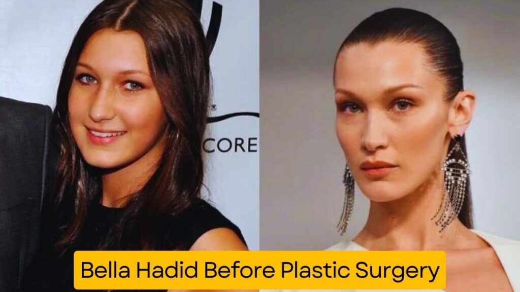 Bella Hadid Before Plastic Surgery