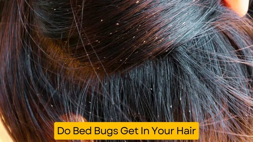 Do Bed Bugs Get In Your Hair