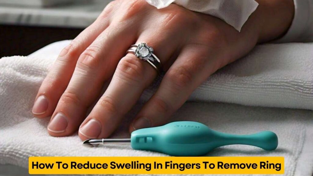 How To Reduce Swelling In Fingers To Remove Ring