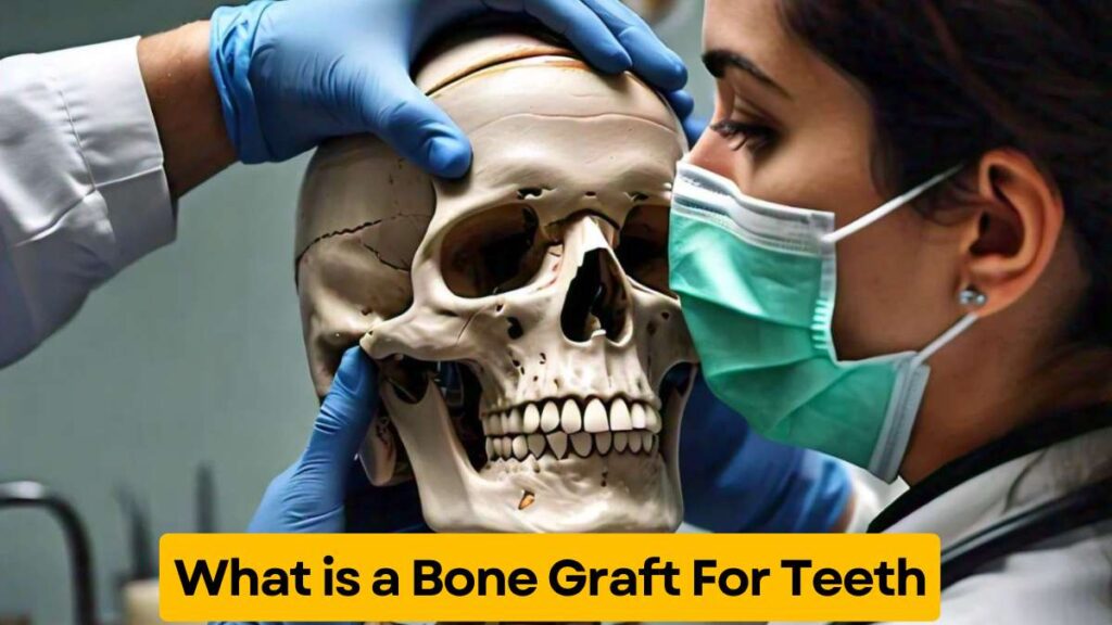 What is a Bone Graft for Teeth